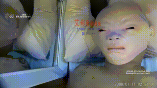 无泪的疤面残忍脚