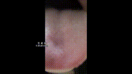 【明视界】明妃丸吞第一视角封面图